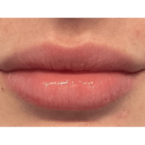 After Image: Lips