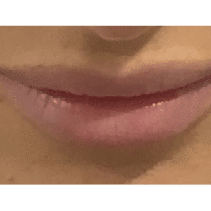 Before Image: Lips