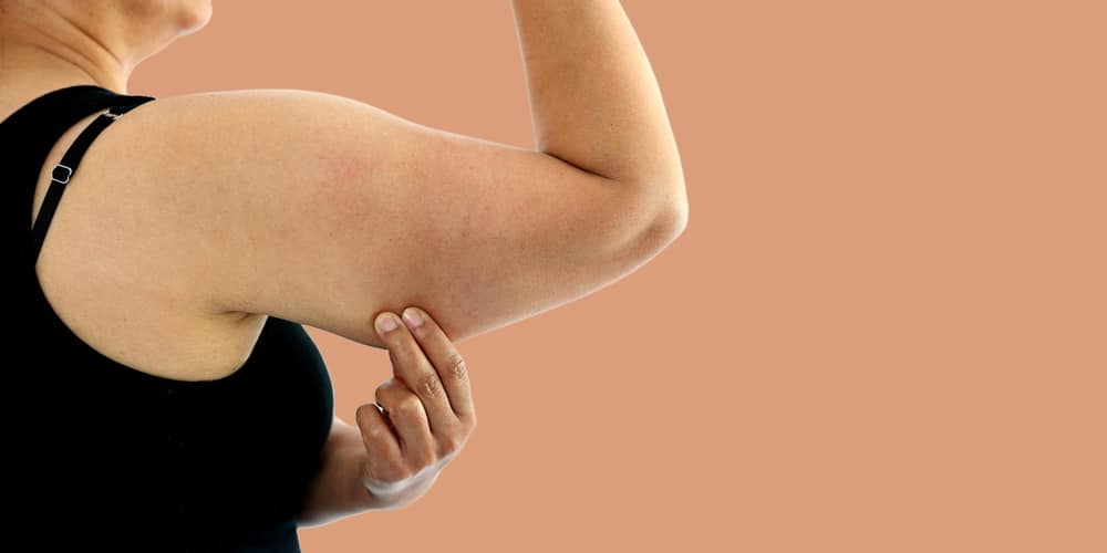 Close up of a woman’s arm as she pinches the loose, lax skin, due to needing tightening treatment.